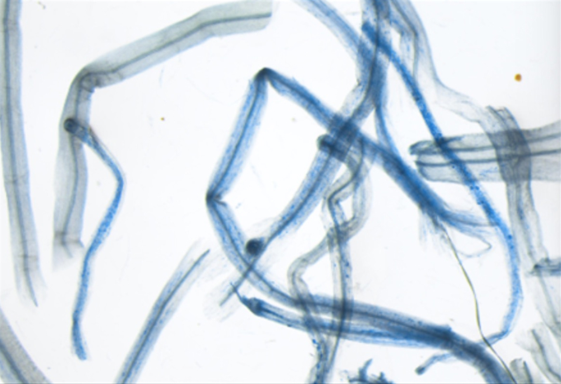 染色液により青く染まった菌根菌の感染（共生）状況