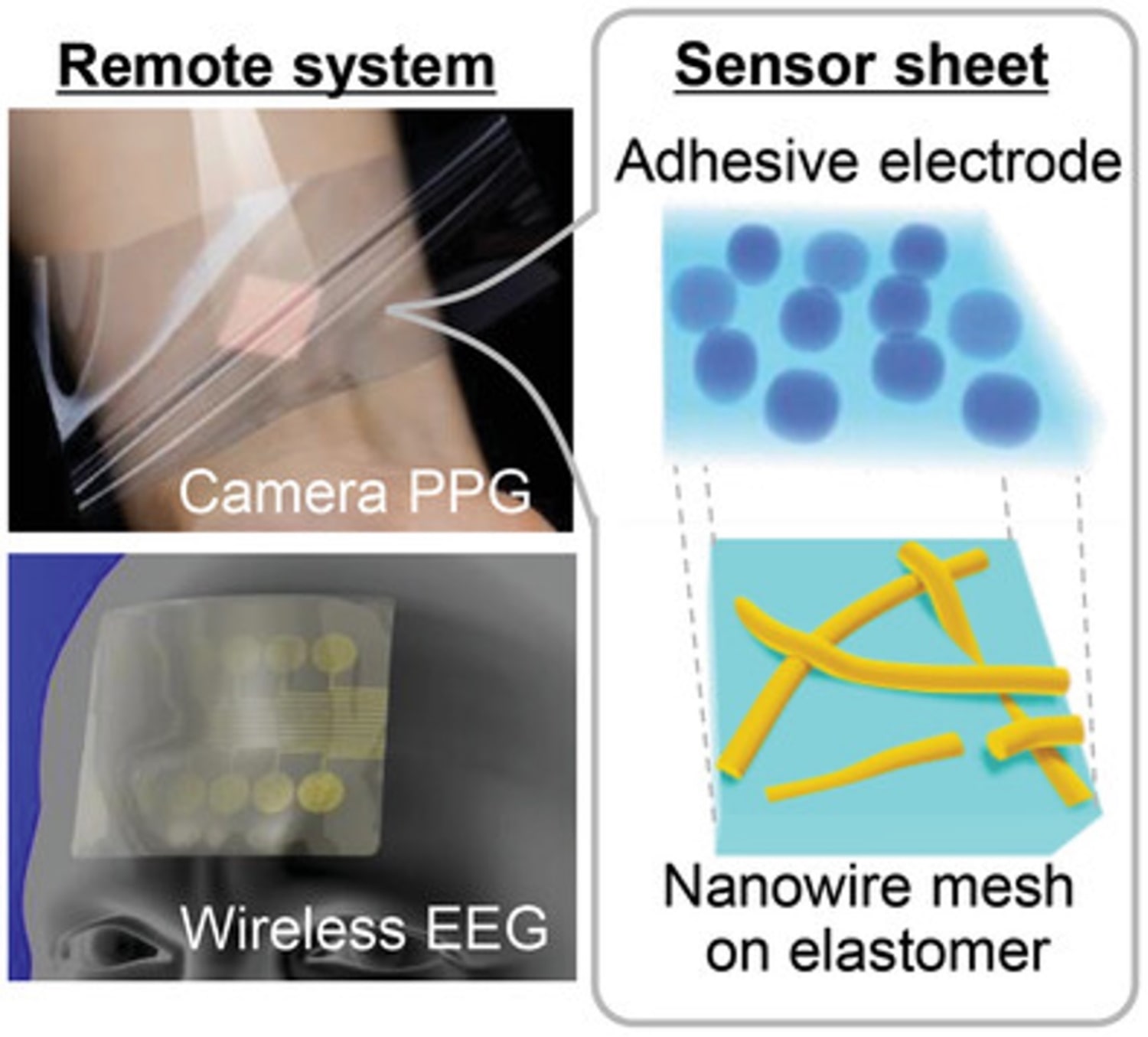 Transparent e-skin using stretchable dry-type bioelectrodes