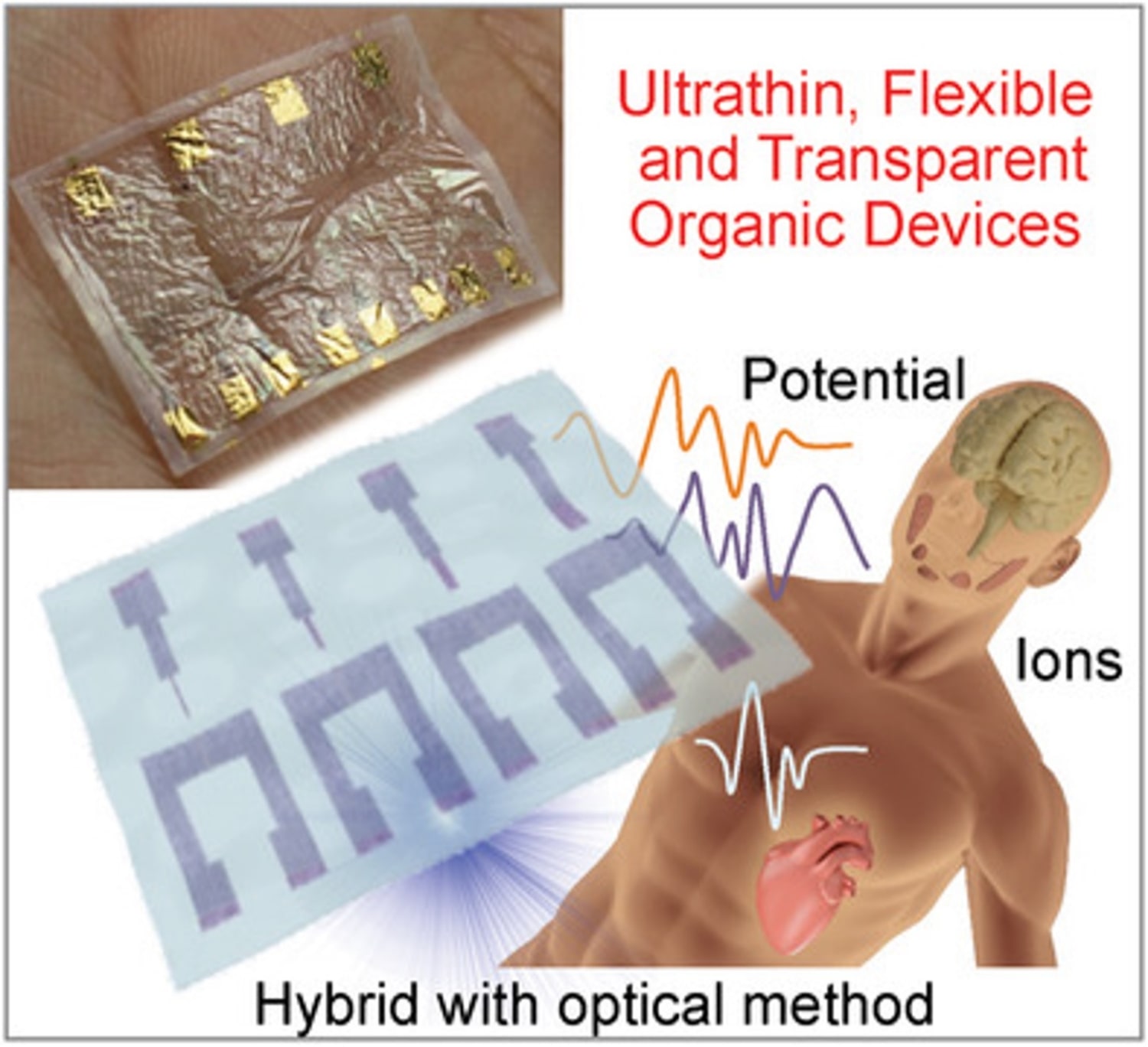 Micro-bioelectrode with amplification function using OECT