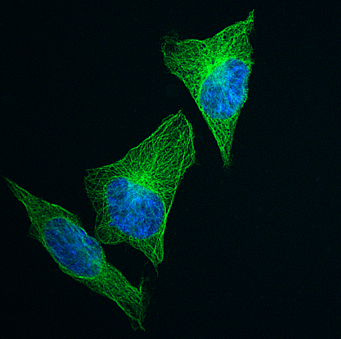 The HeLa cells