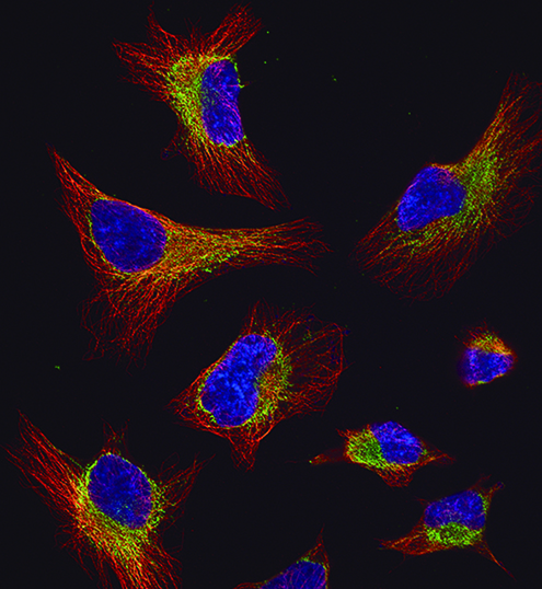 The nuclei of HeLa cells