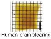 The clearing of human brain tissue large blocks by CUBIC