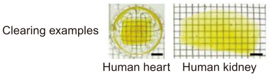 The clearing procedure of human brain tissue large blocks by CUBIC